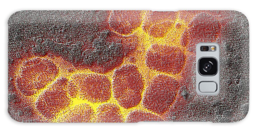 Transmission Electron Micrograph Galaxy Case featuring the photograph Smallpox Virus #3 by Scott Camazine