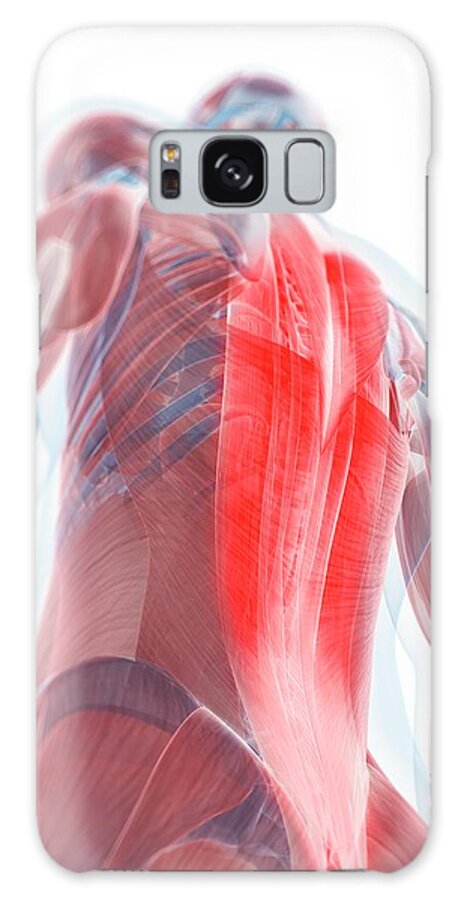 Physiology Galaxy Case featuring the digital art Back Pain, Conceptual Artwork #48 by Sciepro