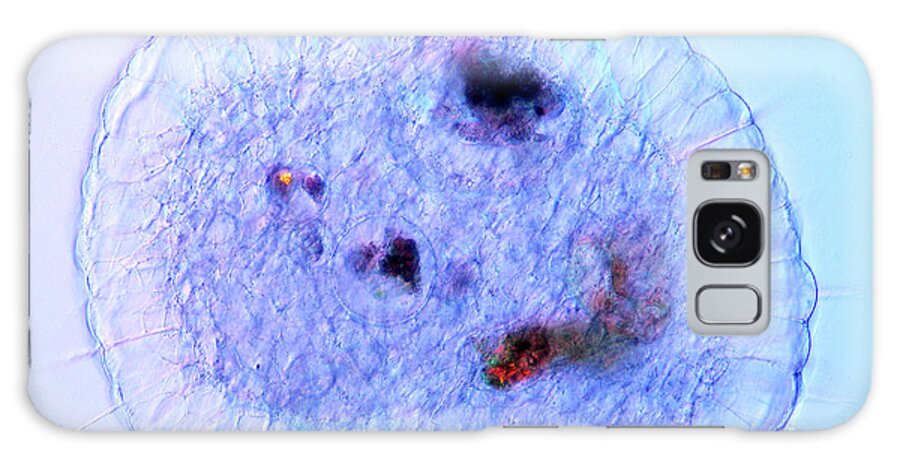 Actinosphaerium Galaxy Case featuring the photograph Actinosphaerium Protozoan #5 by Marek Mis
