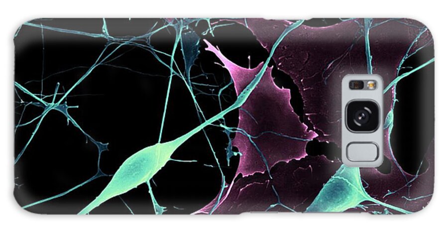 Astrocyte Galaxy Case featuring the photograph Pyramidal Neurons From Cns #5 by Dennis Kunkel Microscopy/science Photo Library