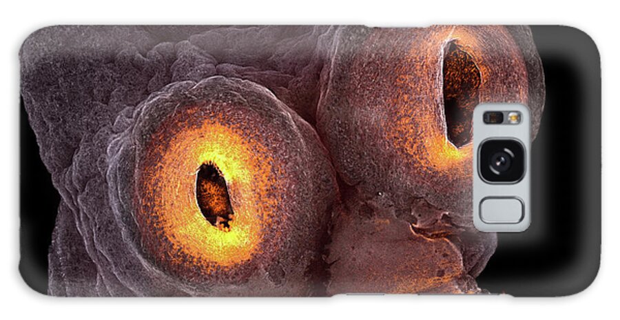 Confocal Galaxy Case featuring the photograph Tapeworm by Teresa Zgoda