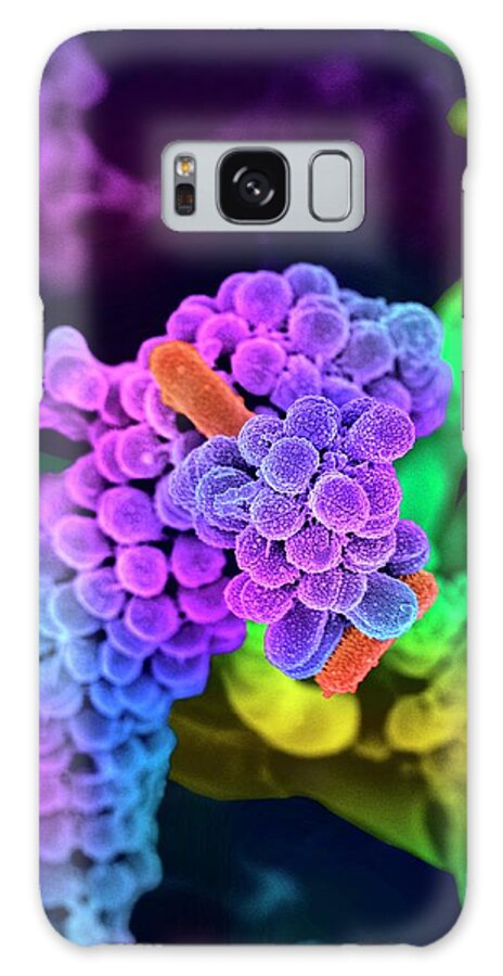 Nobody Galaxy Case featuring the photograph Oral Bacteria #9 by Science Photo Library