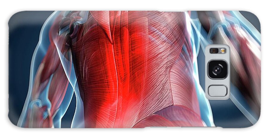 Physiology Galaxy Case featuring the digital art Back Pain, Conceptual Artwork by Science Photo Library - Sciepro