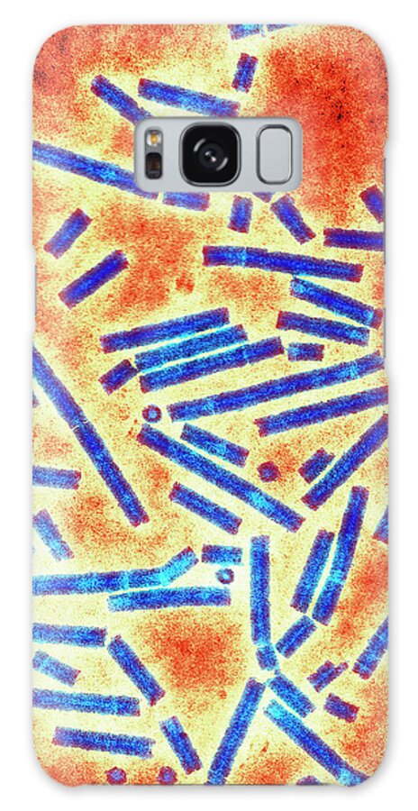 Barley Stripe Mosaic Virus Galaxy Case featuring the photograph Barley Stripe Mosaic Virus by Centre For Bioimaging, Rothamsted Research/science Photo Library