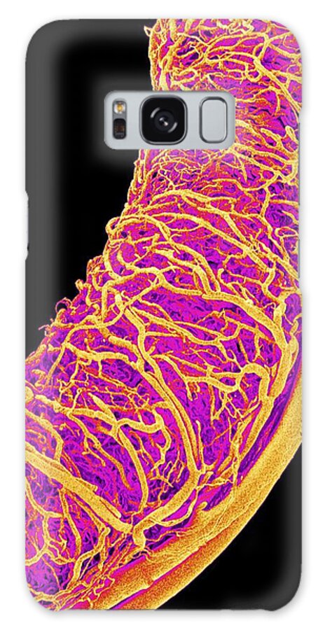 Vein Galaxy Case featuring the photograph Blood Vessels Supplying A Testis by Susumu Nishinaga