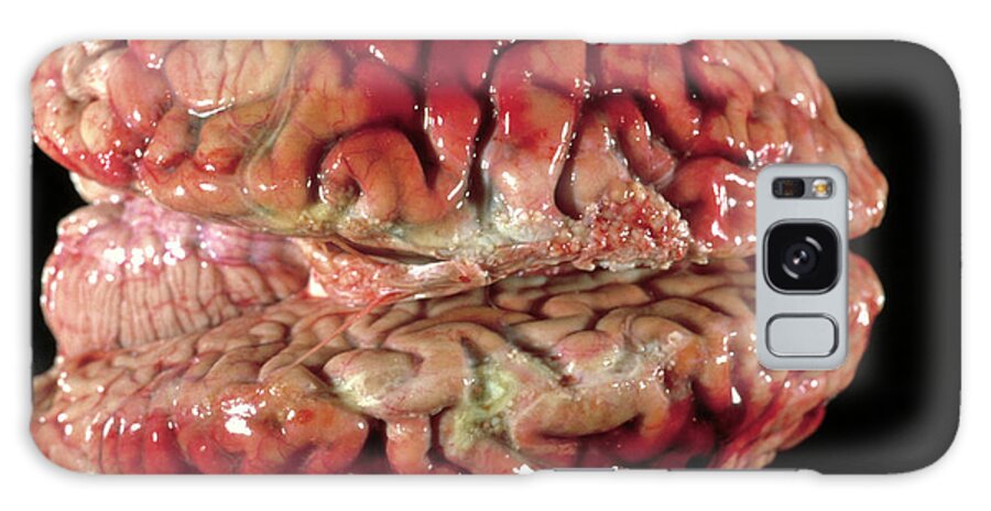 Brain Galaxy S8 Case featuring the photograph Bloody Brain Membranes by Cnri/science Photo Library