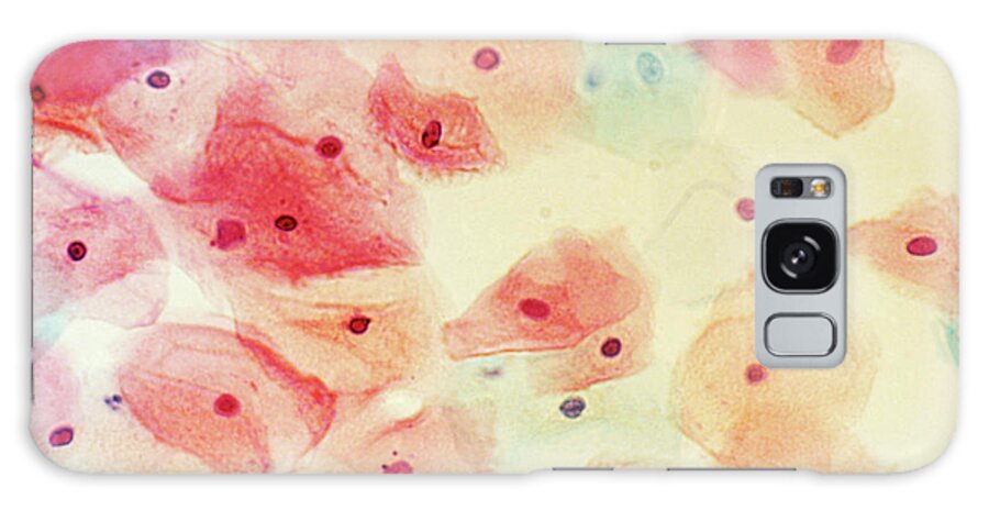 Cervical Smear Galaxy Case featuring the photograph Cervical Smear Mid-cycle by Science Photo Library.