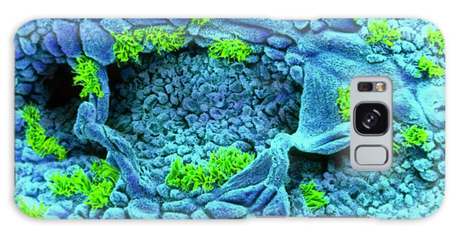 Uterus Galaxy Case featuring the photograph Coloured Sem Of Uterus Wall (early Proliferation) by Dr Yorgos Nikas/science Photo Library