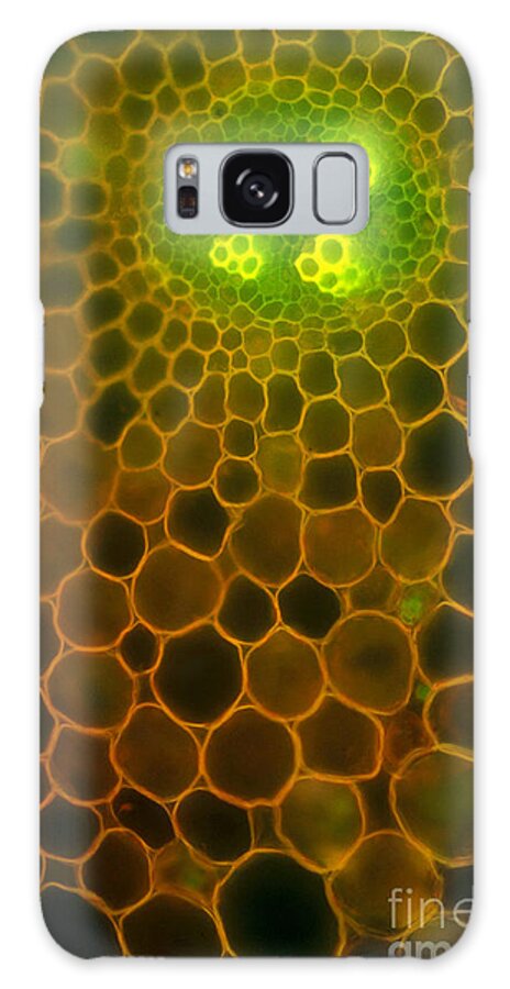 Ranunculus Galaxy Case featuring the photograph Dicot Root by P. Dayanandan