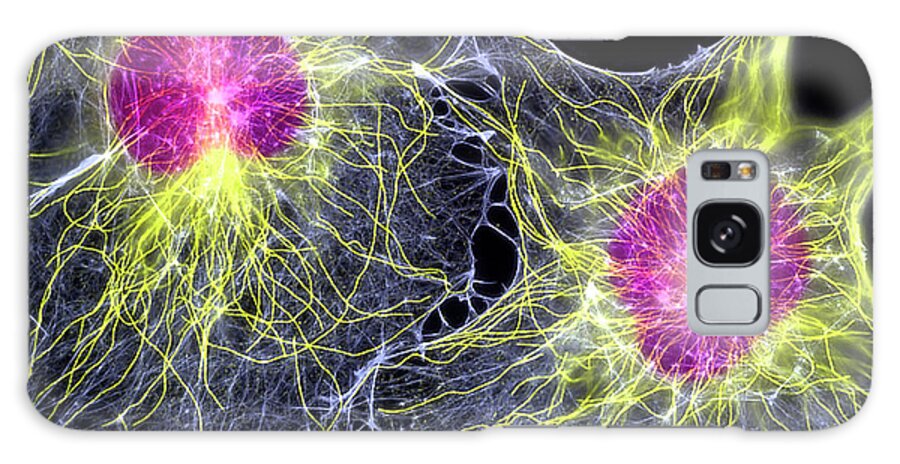 Fibroblast Galaxy Case featuring the photograph Fibroblast Cells Showing Cytoskeleton by Dr Torsten Wittmann