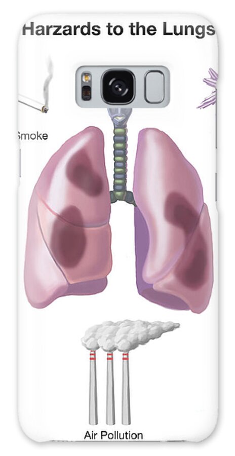 Science Galaxy Case featuring the photograph Hazards To The Lungs by Spencer Sutton
