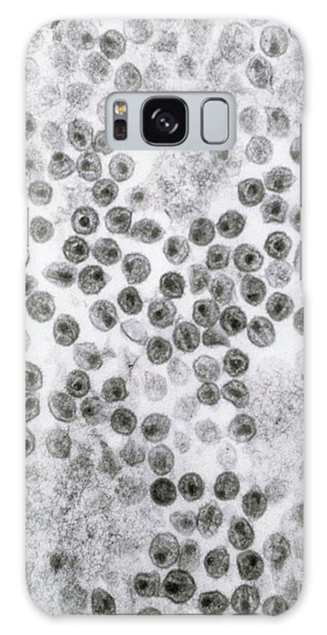 Hiv Galaxy Case featuring the photograph Hiv Virus by David M. Phillips