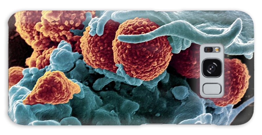 Mrsa Galaxy Case featuring the photograph Mrsa Ingestion By White Blood Cell by Ami Images