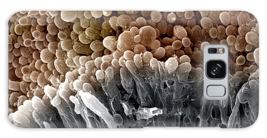 Mushroom Galaxy Case featuring the photograph Mushroom Spores (agaricus Bisporus) by Science Stock Photography/science Photo Library