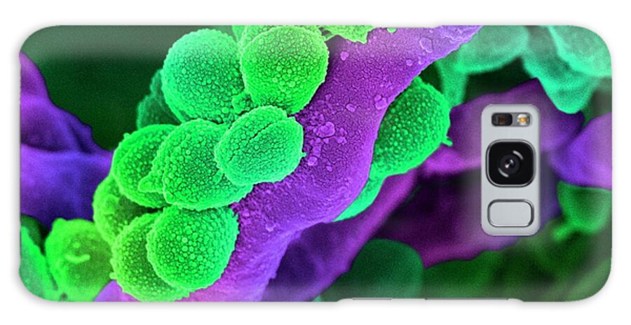 Streptococcus Galaxy Case featuring the photograph Oral Streptococcus Bacteria by Science Photo Library