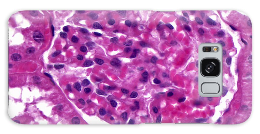 Kidney Galaxy Case featuring the photograph Renal Corpuscle, Lm by Alvin Telser