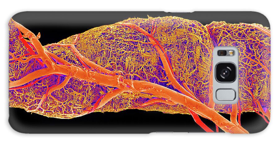 Duodenum Galaxy Case featuring the photograph Small Intestine Blood Vessels by Susumu Nishinaga