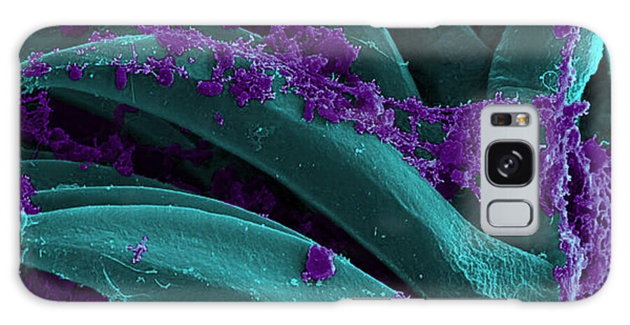 Microbiology Galaxy Case featuring the photograph Yersinia Pestis Bacteria, Sem #5 by Science Source