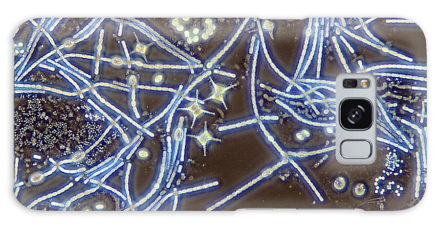 Anoptral Contrast Microscope Galaxy Case featuring the photograph Anabaena Staurastrum Anoptral Contrast by M I Walker