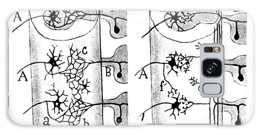 Science Galaxy Case featuring the photograph Neuroglia Cells Illustrated By Cajal by Science Source