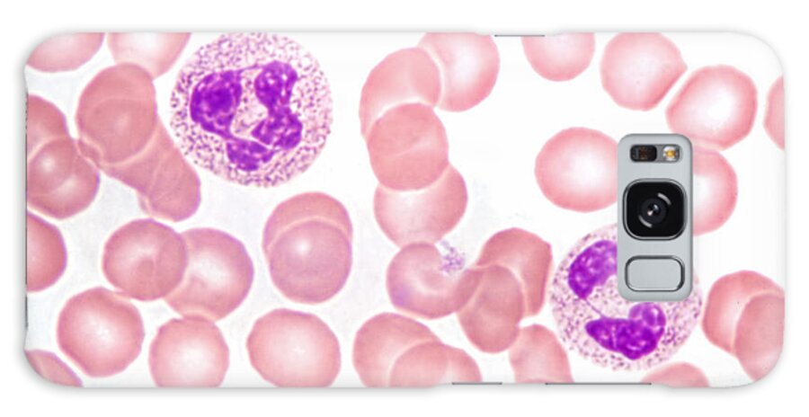 Neutrophil Polymorphs Galaxy Case featuring the photograph Neutrophils In Peripheral Blood Smear by M. I. Walker