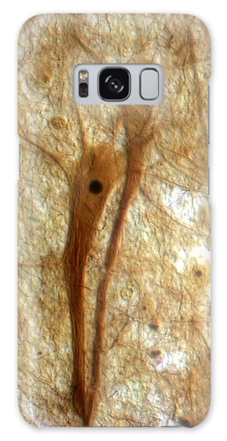 Pyramidal Neuron Galaxy Case featuring the photograph Pyramidal Neurons, Light Micrograph by Robert Markus