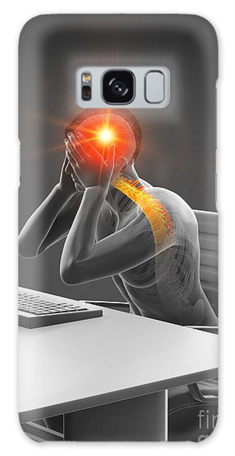 Pain Galaxy Case featuring the photograph Office Worker With Headache #6 by Sebastian Kaulitzki/science Photo Library