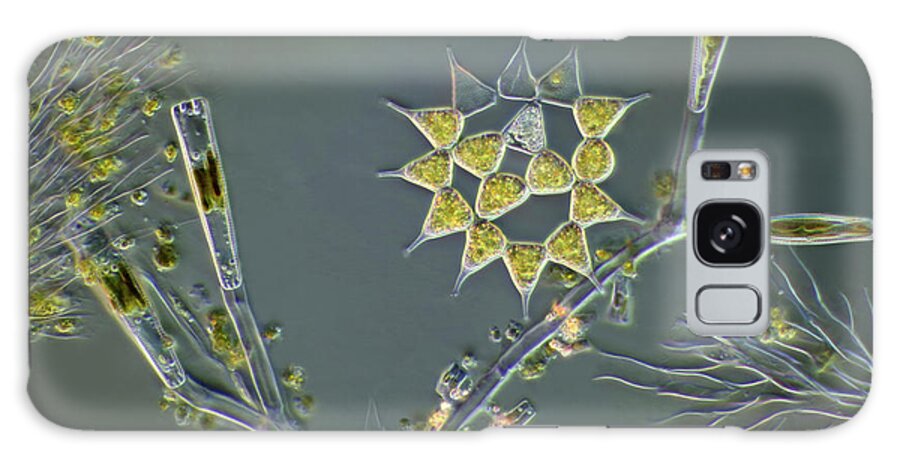 Algae Galaxy Case featuring the photograph Algae by Marek Mis/science Photo Library