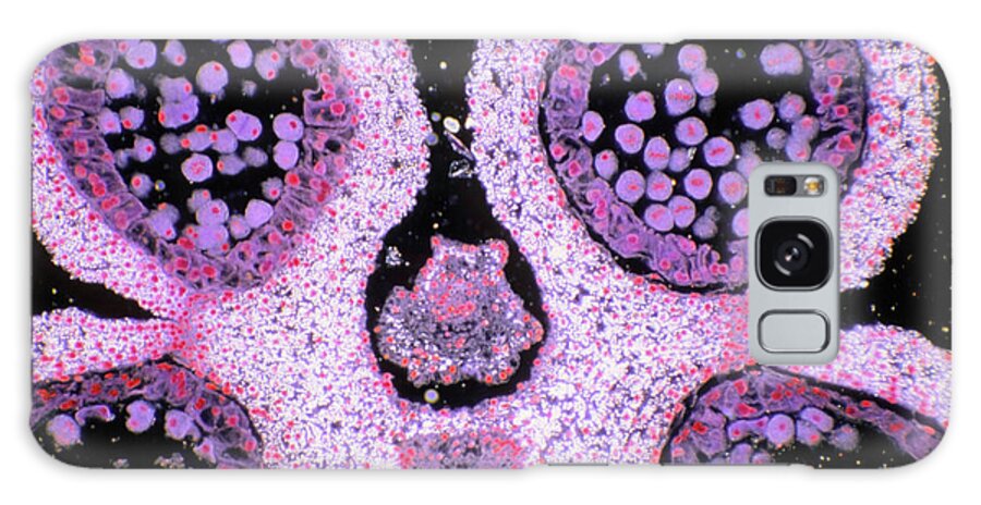 Anther Galaxy Case featuring the photograph Section Through A Lily Anther With Pollen by Astrid & Hanns-frieder Michler/science Photo Library