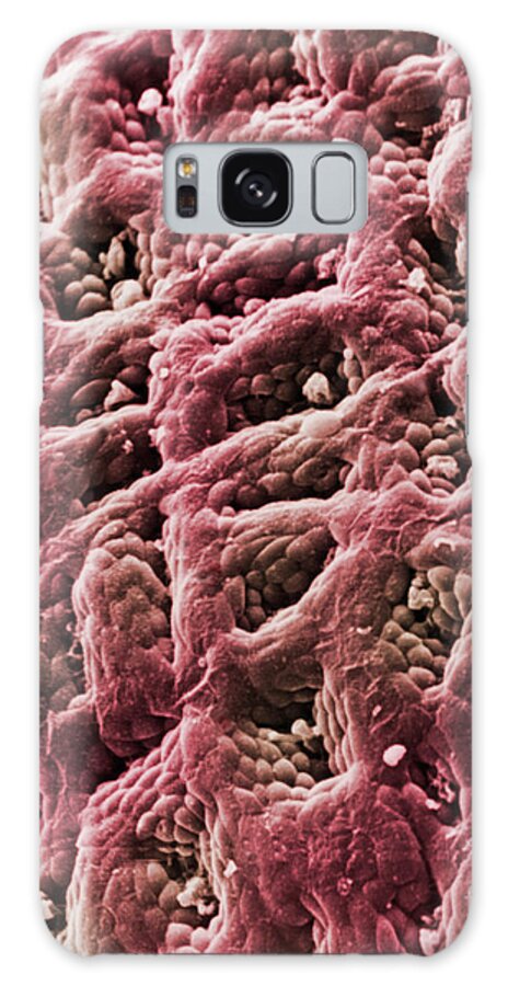 Gastric Pits Galaxy Case featuring the photograph Surface Of The Stomach by Dr Richard Kessel / Science Photo Library