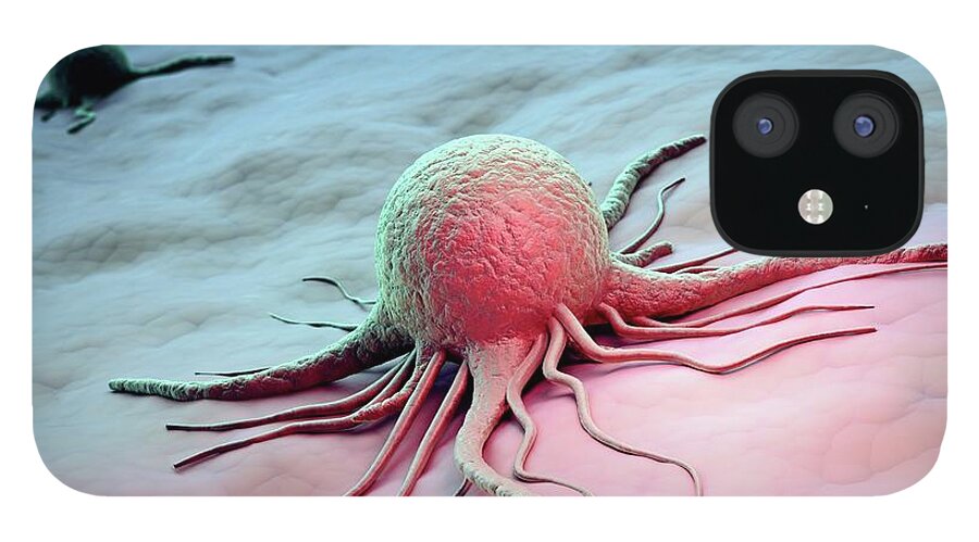 Pathogen iPhone 12 Case featuring the digital art Cancer Cells, Artwork by Andrzej Wojcicki