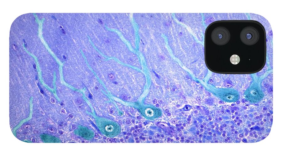 Brain iPhone 12 Case featuring the photograph Nerve Cells, Light Micrograph by Science Photo Library - Steve Gschmeissner