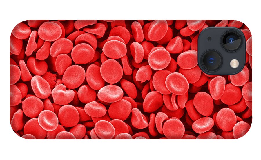 Red Blood Cells iPhone 13 Case featuring the photograph Red Blood Cells, Sem #4 by Scimat