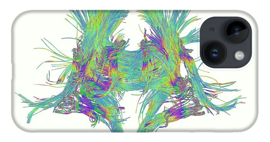 Brain Scan iPhone Case featuring the photograph White Matter Fibres Of The Human Brain by Alfred Pasieka