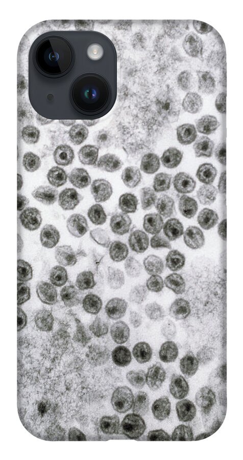 Hiv iPhone 14 Case featuring the photograph Hiv Virus by David M. Phillips