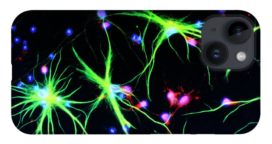 Magnified Image iPhone 14 Case featuring the photograph Nerve Cells by Nancy Kedershaucla