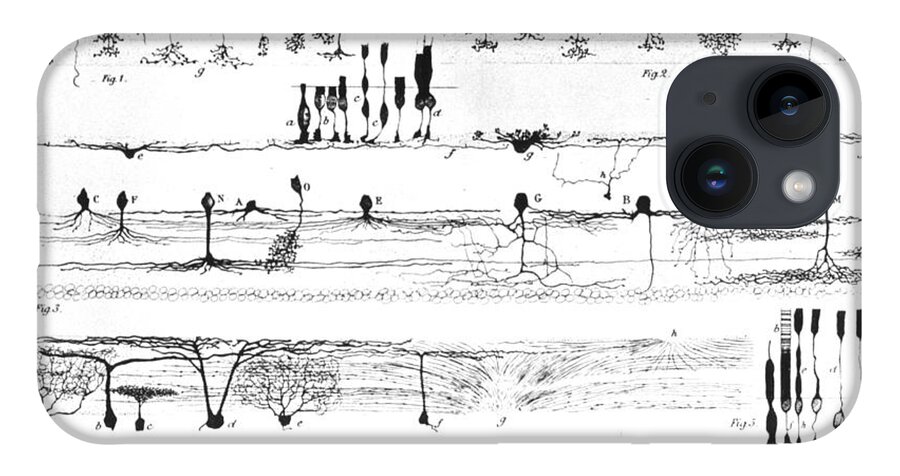 Nerve Structure iPhone 14 Case featuring the photograph Nerve Structure of the Retina by NLM and Photo Researchers