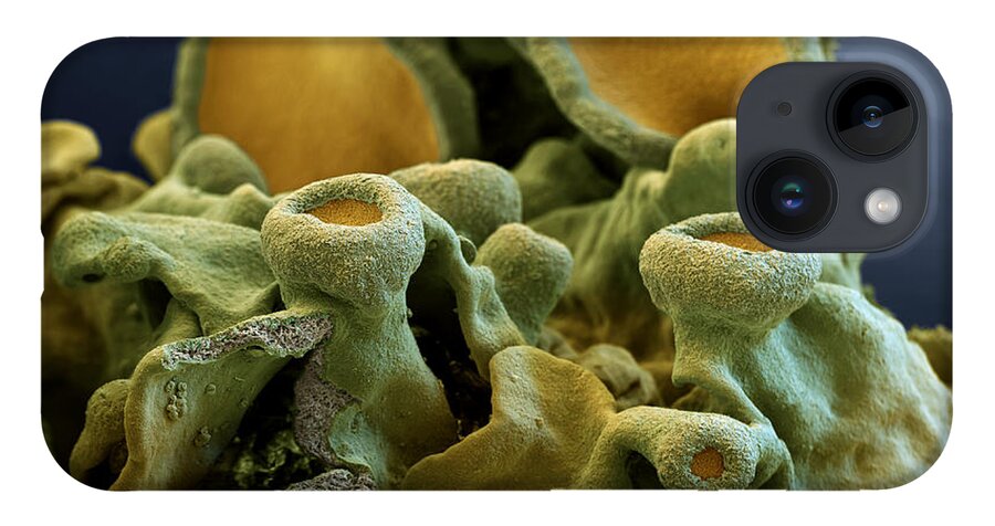 Algae iPhone Case featuring the photograph Common Orange Lichen by Meckes/ottawa