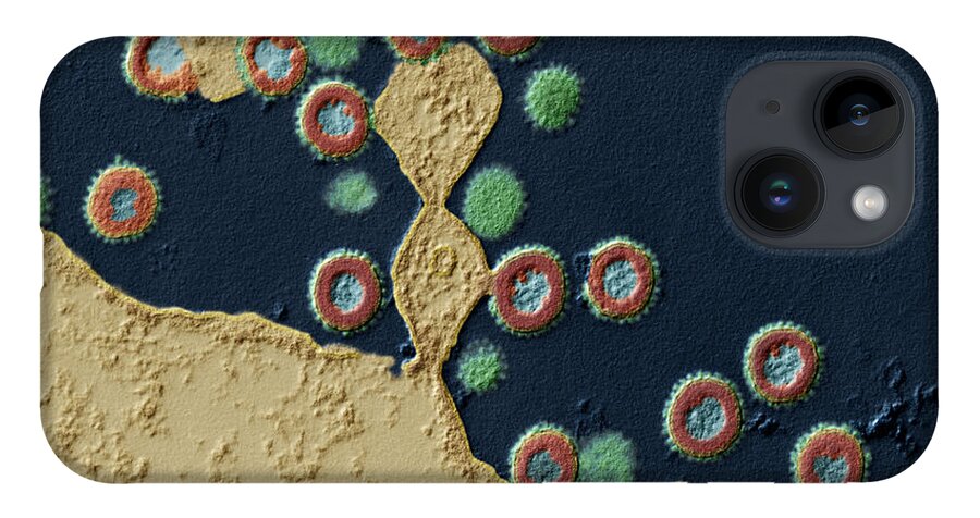 Acquired Immune Deficiency iPhone 14 Case featuring the photograph Effect Of Protease Inhibitors On Hiv Tem by Meckes/ottawa