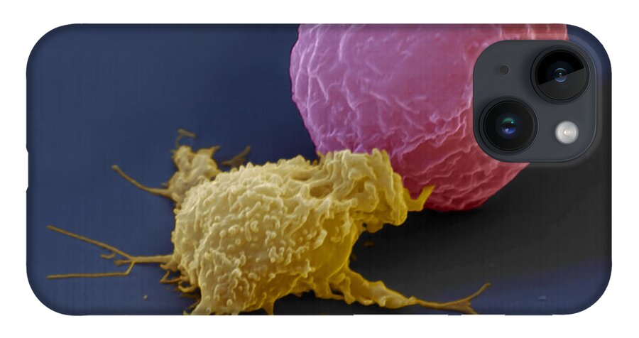Antigen iPhone 14 Case featuring the photograph Killer Cell And Cancer Cell by Meckes/ottawa