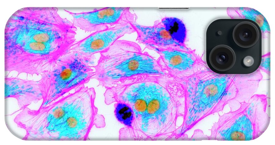 Cell iPhone Case featuring the photograph Cells Stained For Proteins #1 by Kevin Mackenzie / University Of Aberdeen / Science Photo Library