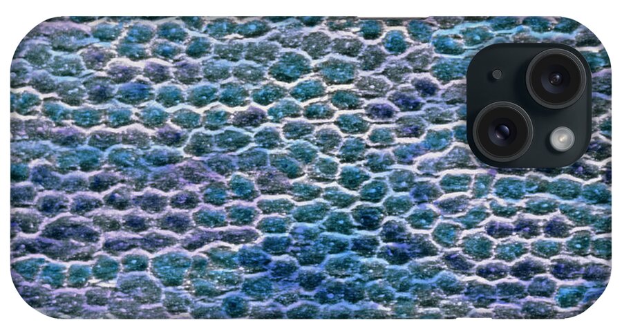Cornea iPhone Case featuring the photograph False-colour Sem Of The Cell Surface Of The Cornea #1 by Prof. P. Motta/dept. Of Anatomy/university \la Sapienza\, Rome/science Photo Library