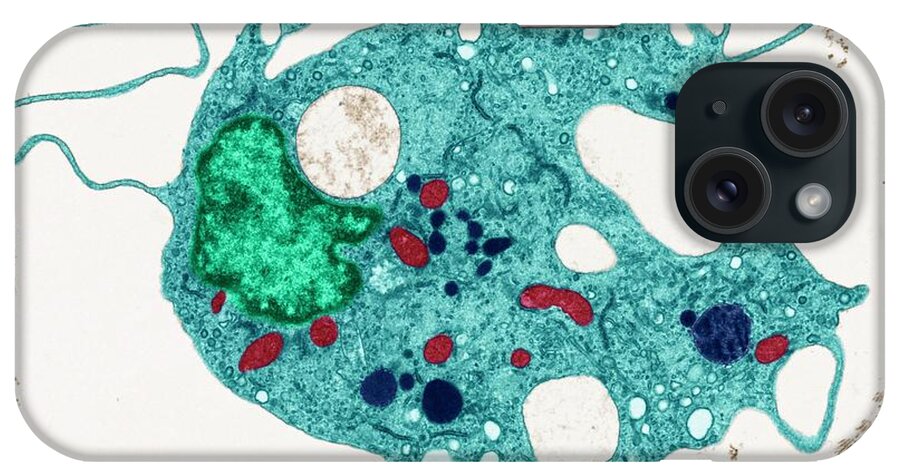 Cell iPhone Case featuring the photograph Fibroblast #1 by Steve Gschmeissner