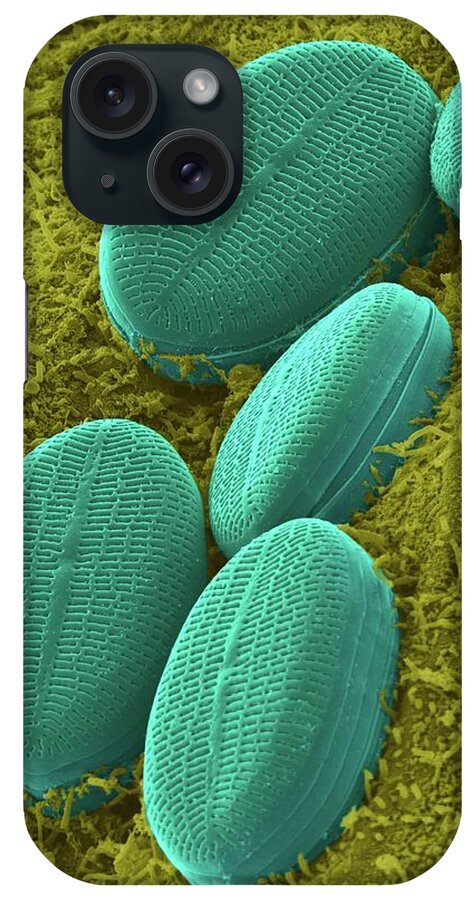 99401a iPhone Case featuring the photograph Fresh Water Pennate Diatom #1 by Dennis Kunkel Microscopy/science Photo Library