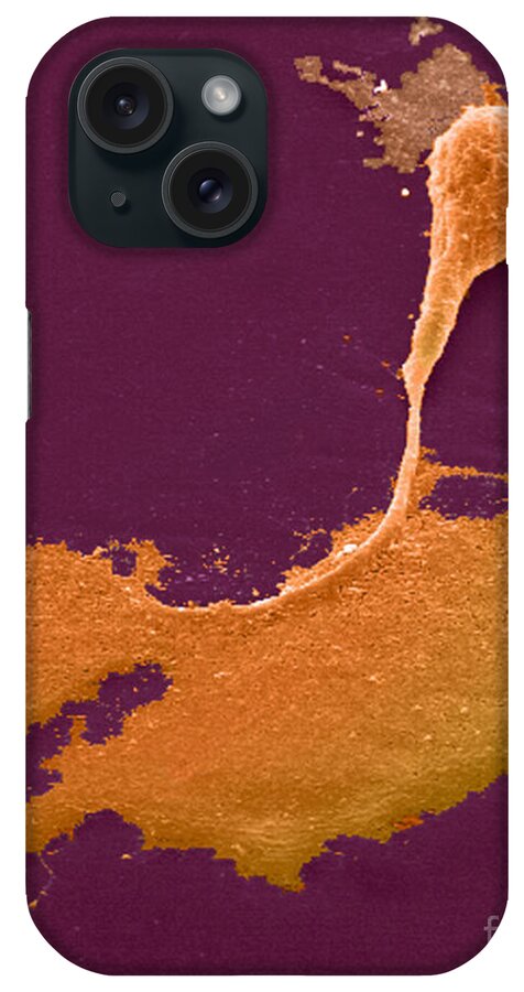 Science iPhone Case featuring the photograph Nerve Cell With Axon And Growth Cone #1 by Science Source