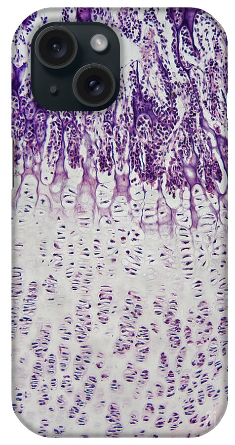 Light Micrograph iPhone Case featuring the photograph Ossification In Kittens Knee Joint #1 by Garry DeLong