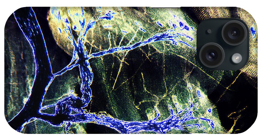 Nerve iPhone Case featuring the photograph Rabbit Neuron Nerve Ending Lm #2 by Garry DeLong