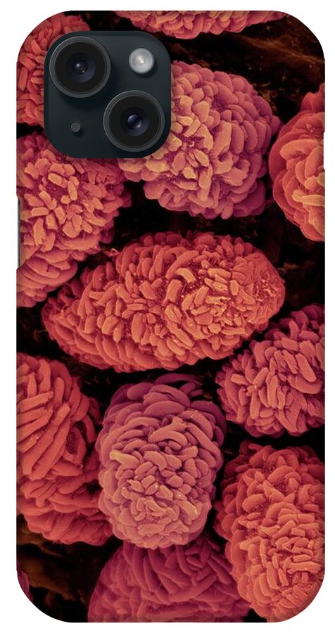 23288b iPhone Case featuring the photograph Toxic Mould Spores (stachybotrys Chartarum) #1 by Dennis Kunkel Microscopy/science Photo Library