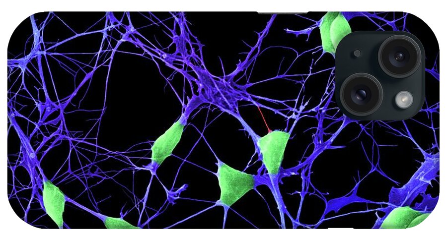 Central Nervous System iPhone Case featuring the photograph Cortical Neurons by Dennis Kunkel Microscopy/science Photo Library