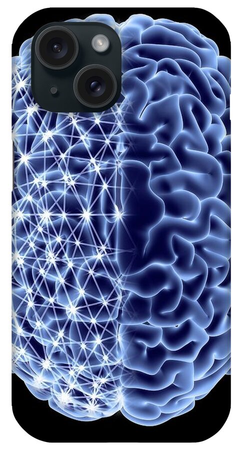 Alzheimer's iPhone Case featuring the photograph Brain #18 by Pasieka
